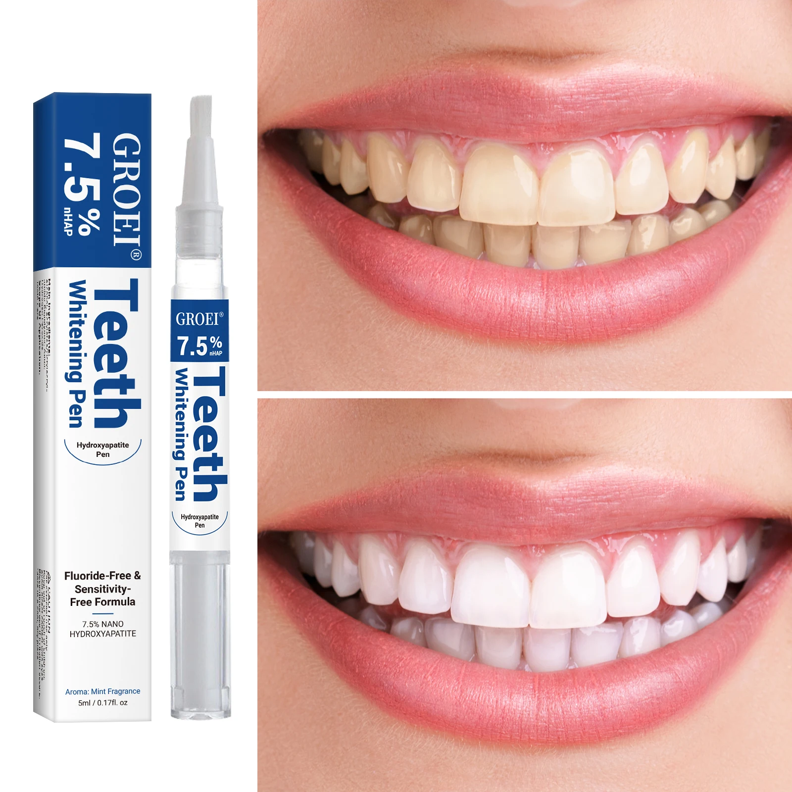 ปากกาฟอกสีฟันไฮดรอกซีอะพาไทต์  - Teeth Whitening Near Me บทวิจารณ์และราคา