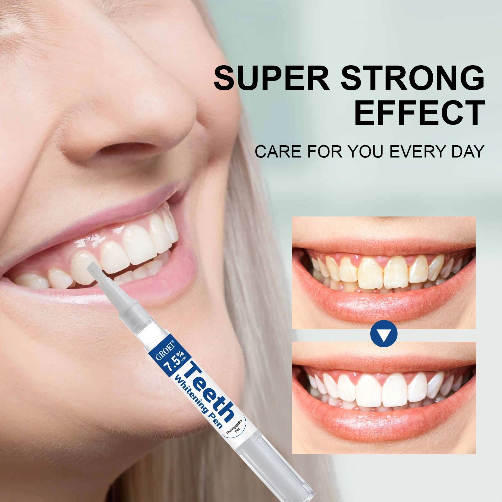 ปากกาฟอกสีฟันไฮดรอกซีอะพาไทต์  - Teeth Whitening Near Me บทวิจารณ์และราคา