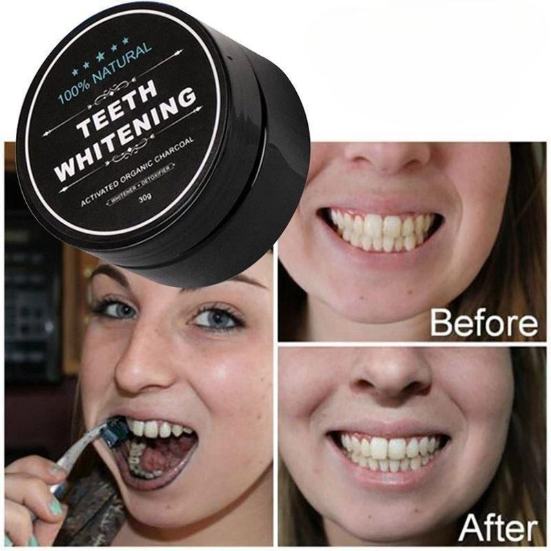 ผงฟอกสีฟันถ่านกัมมันต์ 1 กล่อง - Teeth Whitening Pens บทวิจารณ์และราคา